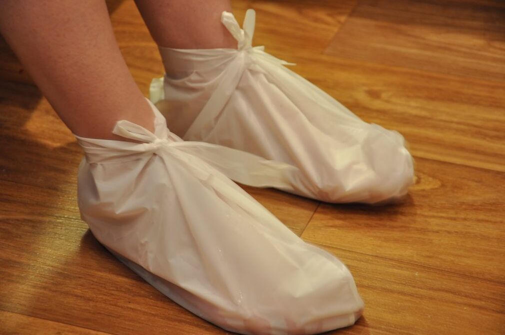 kompresai nuo čiurnos artrozės