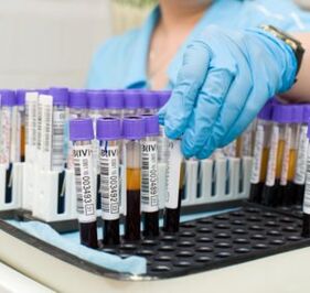 kraujo tyrimas sąnarių skausmui diagnozuoti