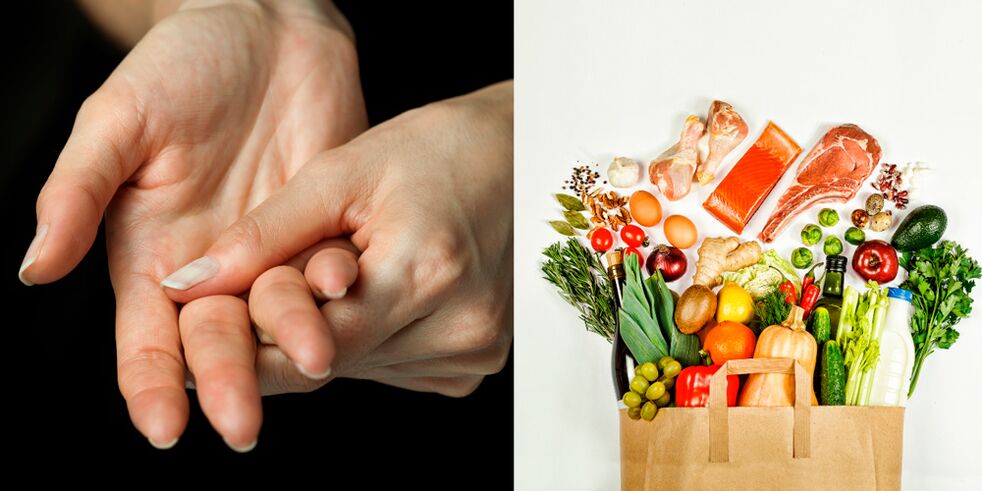 podagrinis rankų artritas ir maisto produktai jo gydymui
