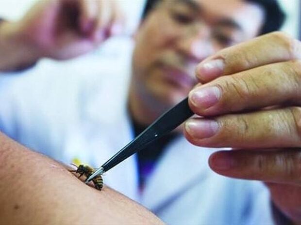 Gimdos kaklelio osteochondrozės apiterapija